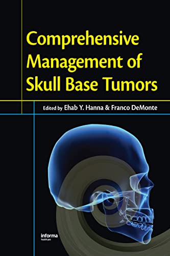 Comprehensive Management of Skull Base Tumors